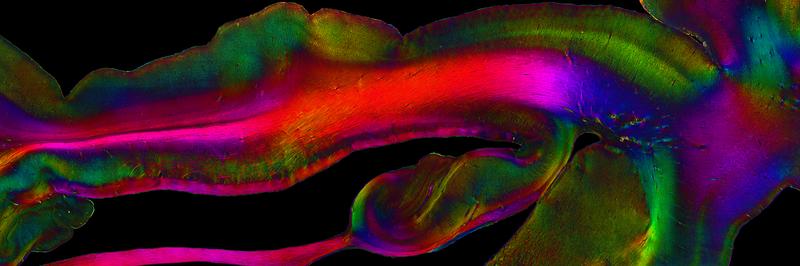 Der Hippocampus, ist eine der in besonders viele Funktionen involvierten Regionen des Gehirns. Hier ist seine Struktur sichtbar gemacht mit dem in Jülich und Düsseldorf entwickelten Verfahren PLI. 