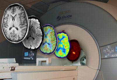 In mehr als 20 000 publizierten Studien mit fMRT und PET-Bildgebung wurden Millionen Hirnbilder und Aktivierungen bei unterschiedlichsten Bedingungen gesammelt.