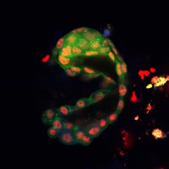 Image depicts a E4.5 mouse blastocyst showing high levels of protein synthesis (green) and HTATSF1 expression (red). 