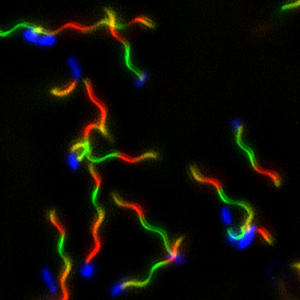 Salmonellen mit angefärbtem Fortbewegungsorganell: Jede Farbe markiert ein Wachstumsintervall von 30 Minuten. Diese Experimente erklären, wie Bakterien ihre Flagellen außerhalb der Zelle aufbauen. 