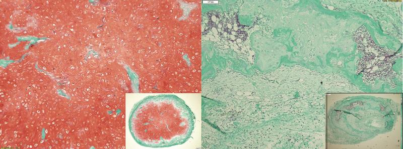 Development of cartilage tissue from mesenchymal stem cells after eight weeks in vivo: Stable cartilage tissue, indicated by red staining (left), versus development towards bone tissue (right).