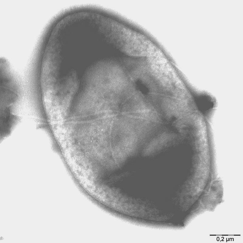 Elektronenmikroskopische Aufnahme von Tritonibacter horizontis. 