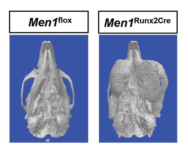 Die Aufnahmen aus dem Mikro-Computertomographen zeigen links den gesunden Unterkiefer einer Wildtypmaus und rechts den Kiefer einer Maus mit einem massiven Kiefertumor