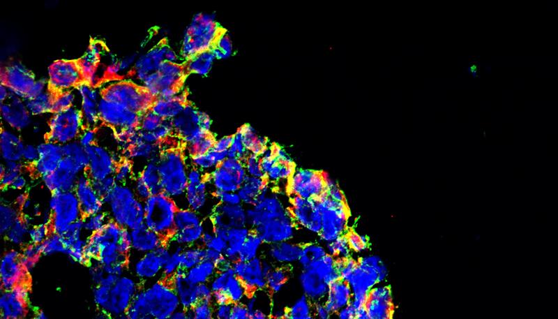 In einem dreidimensionalen Darmkrebs-Zellkulturmodell werden durch den Wirkstoff KP-1339 (IT-139) Merkmale ausgelöst, die im Organismus den immunogenen Zelltod hervorrufen.