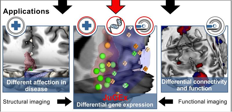 Der mediale Frontalpol (rot) ist bei Depression betroffen. JuGEx ermöglicht die Lokalisierung von Genexpressionsdaten aus Gewebeproben (farbige Kugeln).