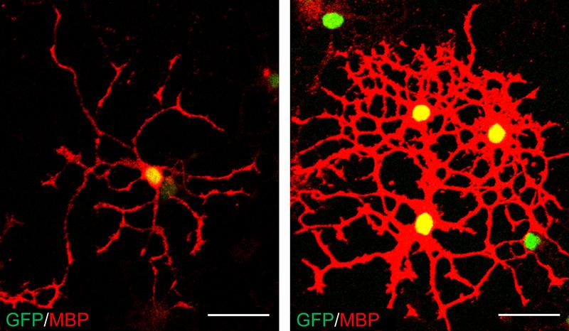 Oligodendrocyten  verfügen vor ihrer Ausreifung (links) nur über vergleichsweise wenige Myelin-Ärmchen. In ausgereiftem Zustand (rechts) sind sie von einem Netz derartiger Fortsätze umgeben. 