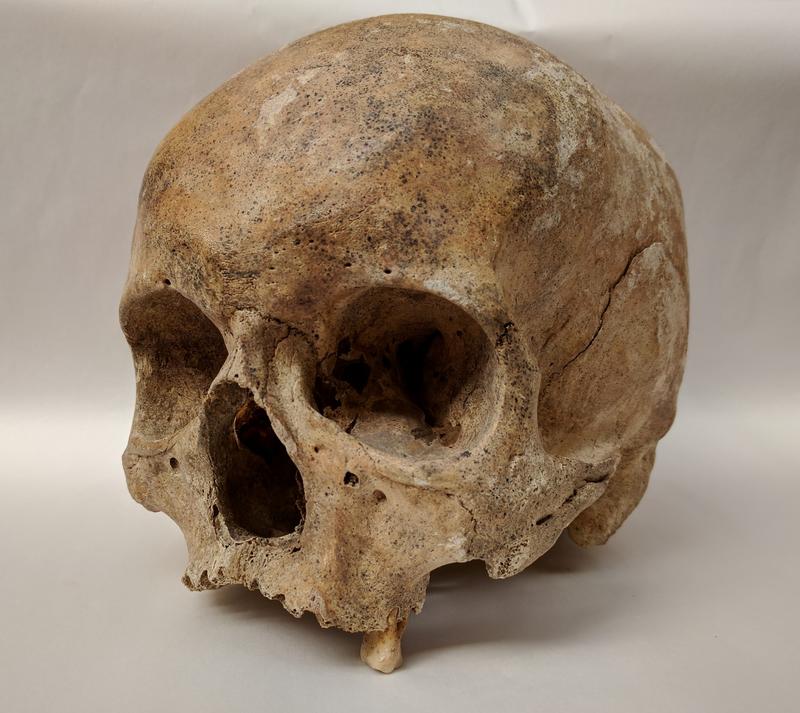 Das Forschungsteam untersuchte mittelalterliche aDNA aus Zähnen und Felsenbein, dem härtesten Knochen des Schädels.