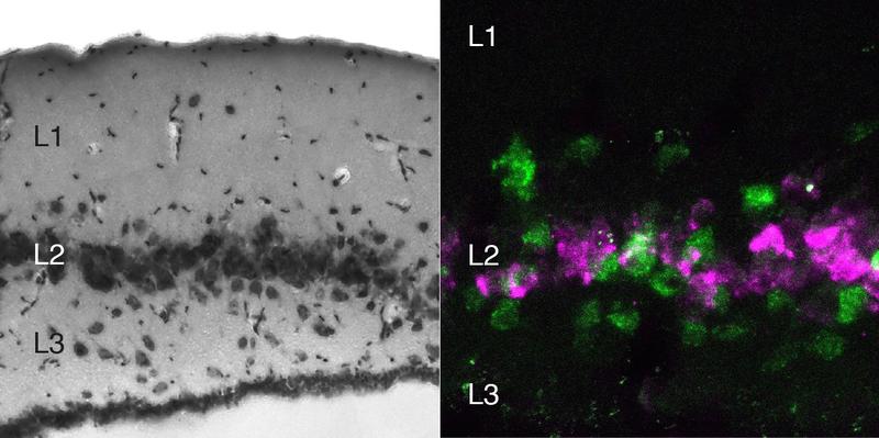 Snapshot of the turtle three-layered cortex (left) and distinct types of neurons in the turtle dorsal cortex (right). 