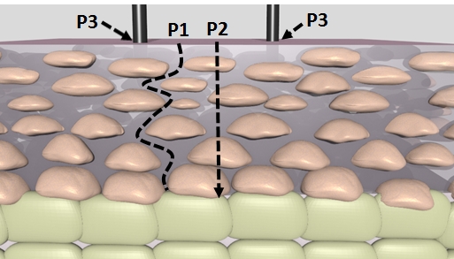 Steam can penetrate into the skin through different pathways: transcellular (P1), intercellular (P2) or transappendageal (P3).