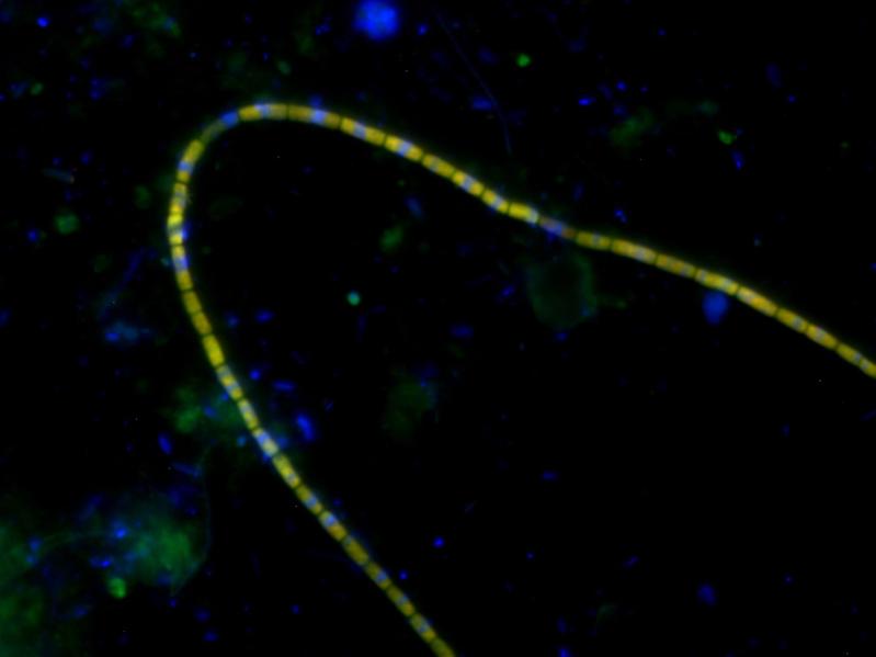 Mit fluoreszierenden Gensonden angefärbte Kabelbakterien.