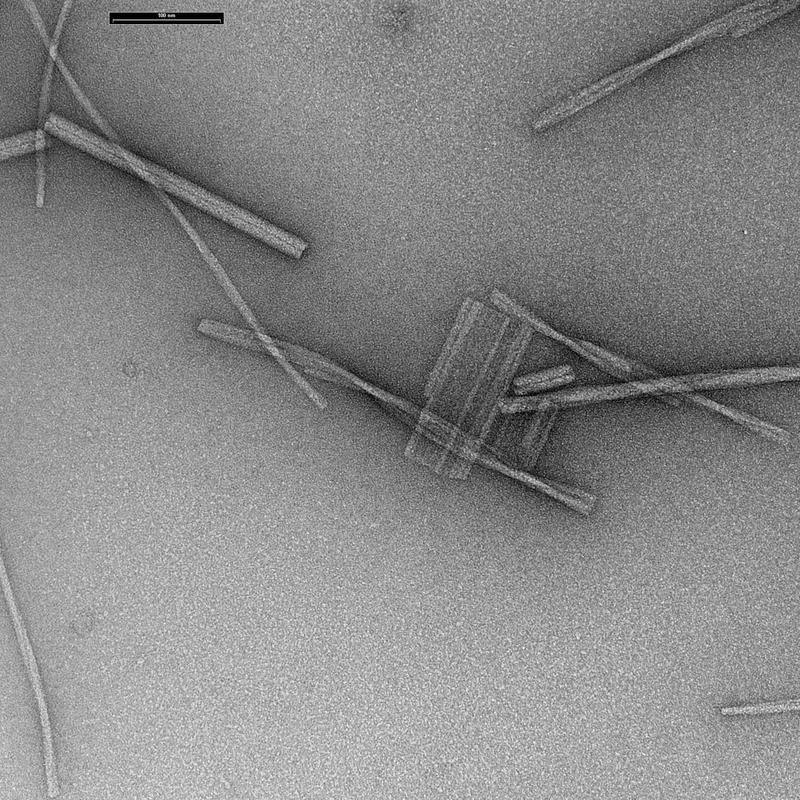 Bombesin-Amyloidfilamente und Filamente des Tabak-Mosaikviru unter dem Elektronenmikroskop.
