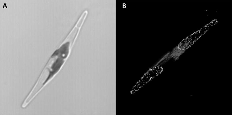 Die Kieselalge Phaeodactylum tricornutum 