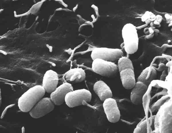 Wie kleine Pillen sehen die Klebsiella pneumoniae-Bakterien aus, die sich an eine Schleimhautzelle der Harnblase angeheftet haben. Die Aufnahme zeigt einen frühen Zeitpunkt der Harnwegsinfektion; die Bakterien sind noch außerhalb der Zellen.