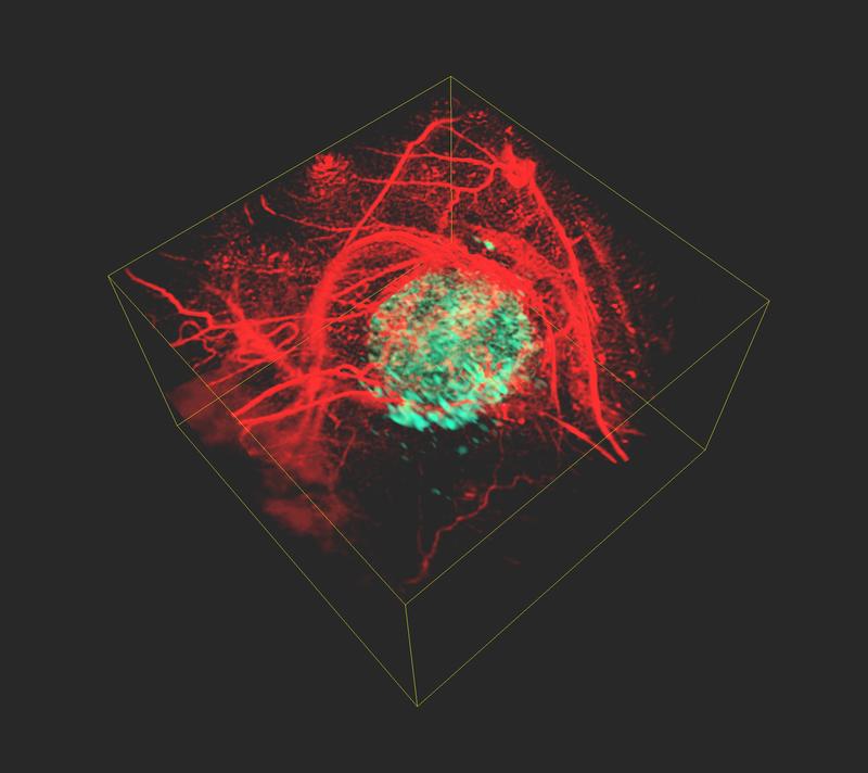 Aufnahme eines Tumors (grün) mit Hilfe der neuen Methode.