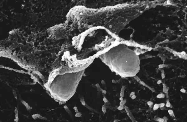 Diese beiden Klebsiella-Bakterien sind schon teilweise in eine Schleimhautzelle der Harnblase eingedrungen. Fotos (2): Ölschläger