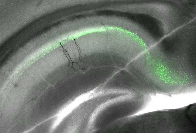 Der Hippocampus, ein Teil des Schläfenlappens, ist eine wichtige Gedächtnisstruktur im Gehirn. Gedächtnisspuren können mit Hilfe von fluoreszierenden Farbstoffen sichtbar gemacht werden 