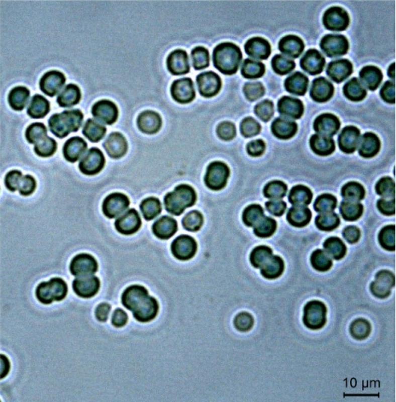 Lichtmikroskopische Aufnahme von Zellen des Cyanobakteriums Synechocystis sp. PCC6803