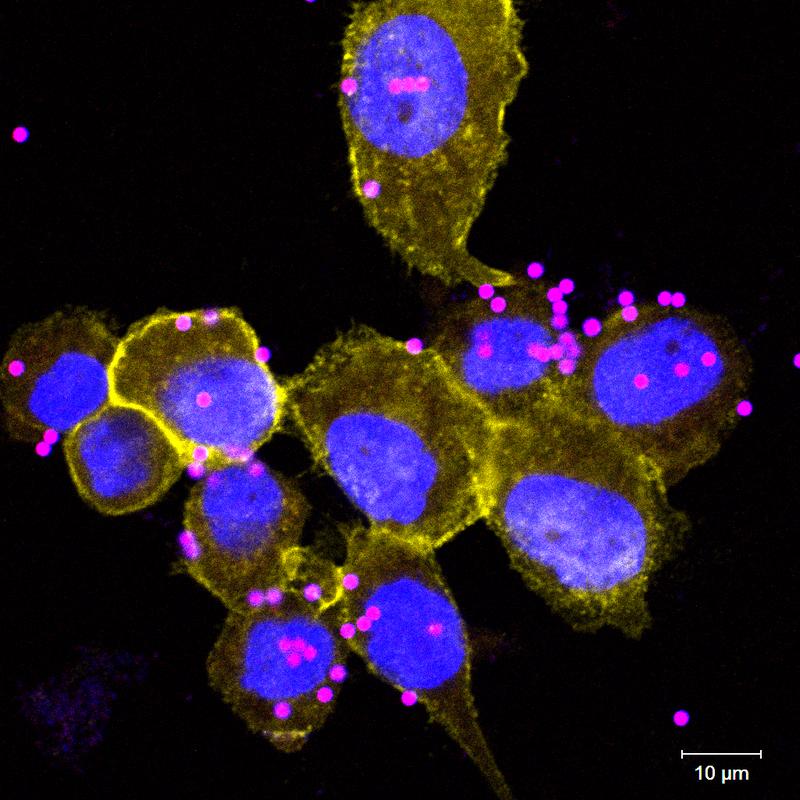 Fluoreszenzmikroskipische Aufnahme von menschlichen Makrophagen (THP-1 Zelllinie), inkubiert mit blau und rot gefärbten Partikeln. Der rote Farbstoff ist nur in saurem Milieu aktiv, gelb = SLC4A7 