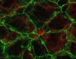 Mikroskopische Aufnahme einer sogenannten Windradstruktur: Eine ENaC positive Stammzelle (rot), umgeben von Ependymzellen. 