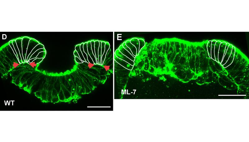 Der Myosin-Inhibitor ML-7 blockiert die Gastrulation und die Zellen werden kaum deformiert.