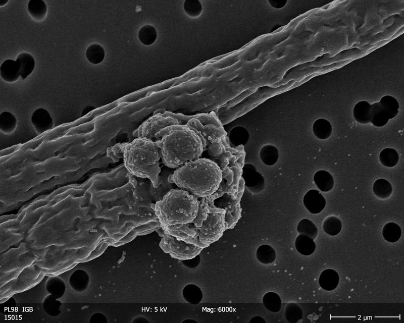 Die Rasterelektronenmikroskop-Aufnahme zeigt zwei cyanobakterielle Filamente, das untere ist infiziert.