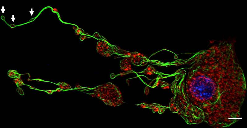 Entstehende Thrombozyten (weiße Pfeile) werden von ihren Vorläuferzellen, den Megakaryozyten, abgeschnürt. 