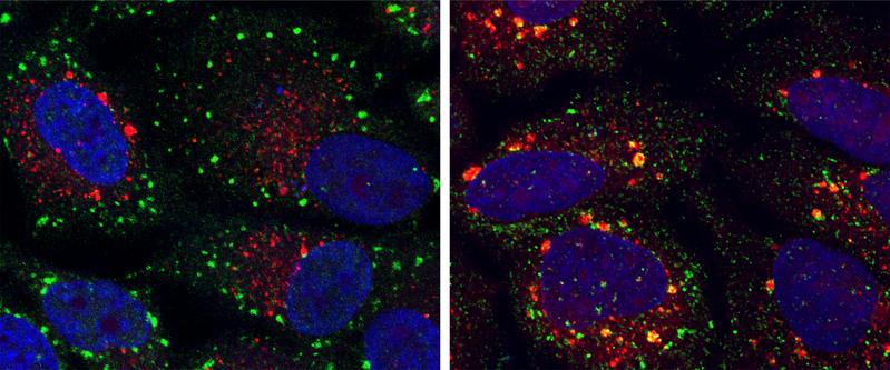 Microscopic colour image showing cells with normal (green dots) and abnormal (yellow dots) stress granules. 