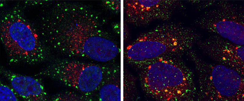 Farbige Mikroskopie-Aufnahmen, die Zellen mit normalen (grüne Punkte) und abnormalen (gelbe Punkte) Stressgranula zeigen. 