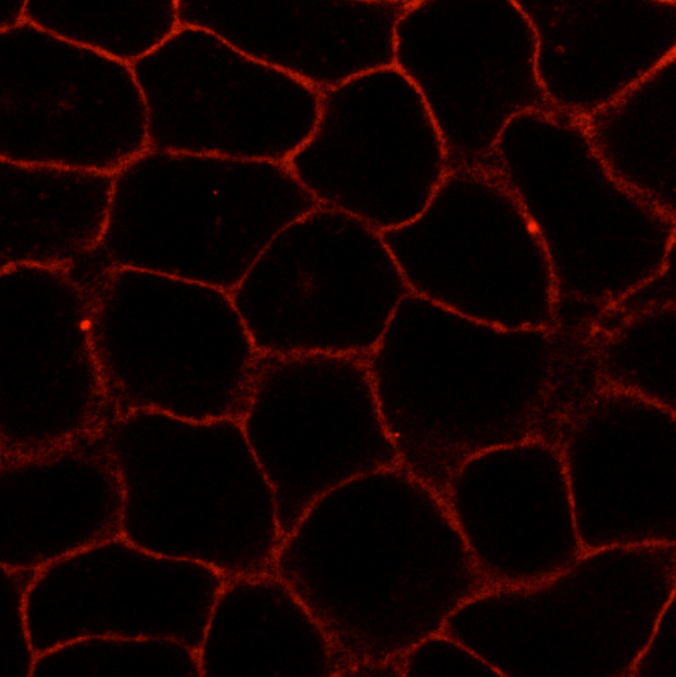 A new compound mimicking natural cholesterol in membranes of living cells (here: HeLa cells). The substance is labelled with a fluorescent dye (red).