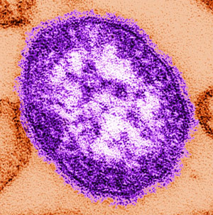 Measles Virus