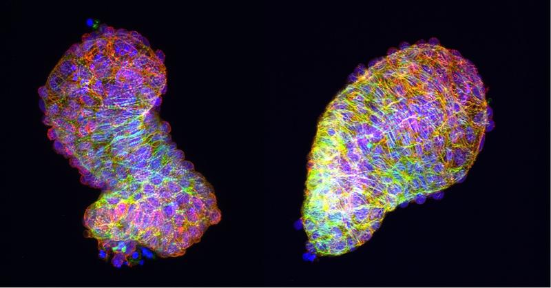 Explantierte Zebrafisch-Herzen bilden ihre Form eigenständig in der Petrischale, (links) – nicht aber, wenn der Frizzled-7a-Faktor des PCP-Signalweges fehlt: Das Herz bleibt ein Schlauch (rechts)