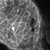 Herzzellen eines Zebrafischembryos finden neu zueinander. Nach fünf Stunden haben die fünf Herzmuskelzellen mit einem initial gemeinsamen Kontaktpunkt einen neuen Zell-Zell-Kontakt ausgebildet (Pfeil)