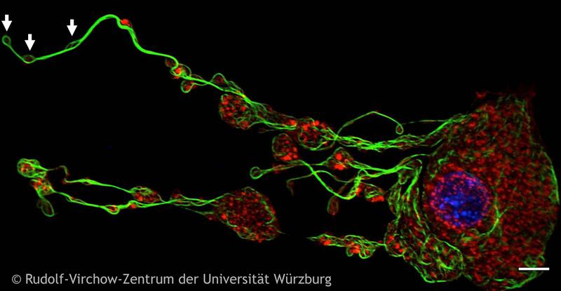 Emerging platelets (white arrows) are buded off by their progenitor cells, the megakaryocytes. Here the cytoskeletal components tubulin (green) and actin (red) and the nucleus (blue) are colored.