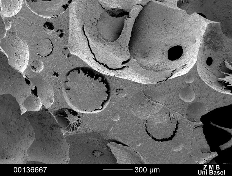 Scanning electron microscopy images confirm the deposition of an extracellular matrix which embeds cells, presumably of both stromal and blood origins. 