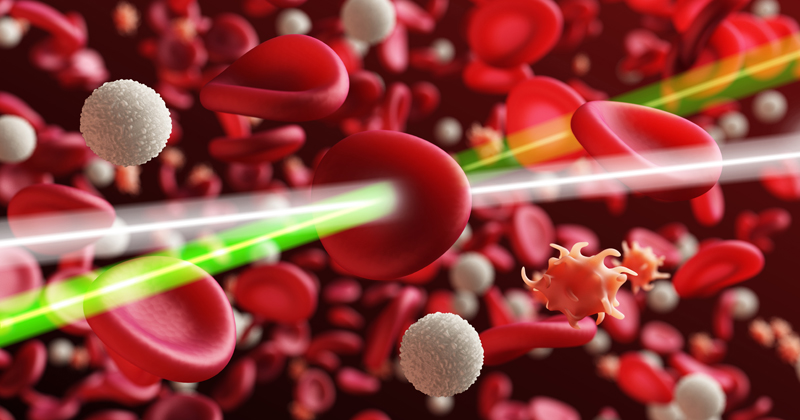 Laserlicht könnte in Zukunft bereits in einer kleinen Blutprobe Hinweise auf Krebszellen finden – und so einen Tumor frühzeitig entdecken helfen. 