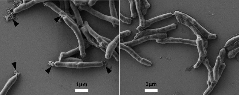 Tuberkulosebakterien, die mit BTZ043 behandelt werden (links), bekommen Löcher und laufen aus.