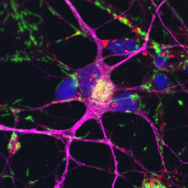 Nerve cells (purple) grown from stem cells derived from Parkinson’s patients. The nuclei are colored blue and the mitochondria green.