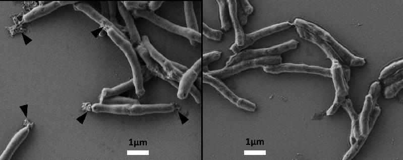 BTZ043 blockiert ein Enzym, das am Aufbau der Zellwand beim Tuberkuloseerreger Mycobacterium tuberculosis beteiligt ist. Der Zellinhalt läuft folglich durch schadhafte Stellen in der Zellwand aus.