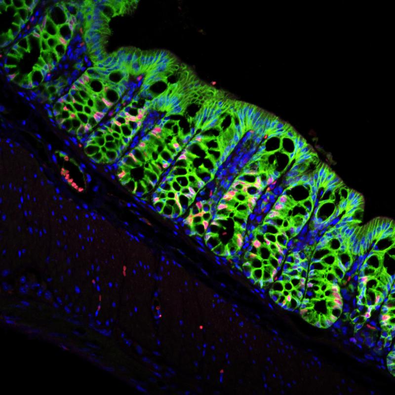 Colon of a mouse with normal stem cell niche