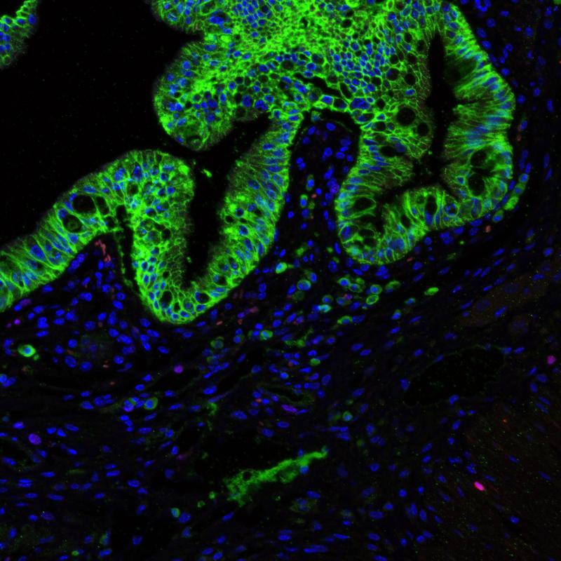Colon of a mouse without stem cell niche
