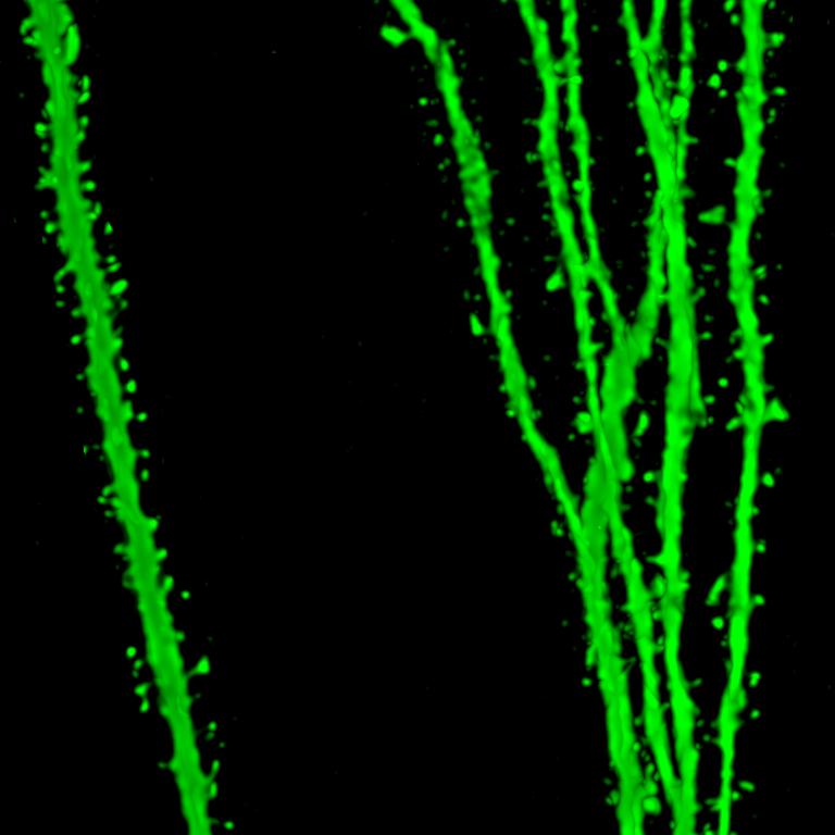 Die Dendriten der neugeborenen Nervenzellen (grün) sind, ähnlich wie die Zweige einer Rose, mit vielen Dornen bewachsen.