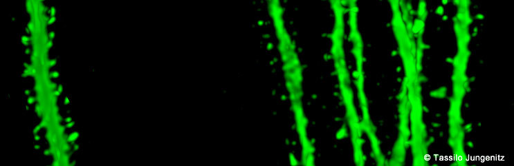 The dendrites of newborn neurons (green) are covered with spines, similar to the thorns on a rose stem