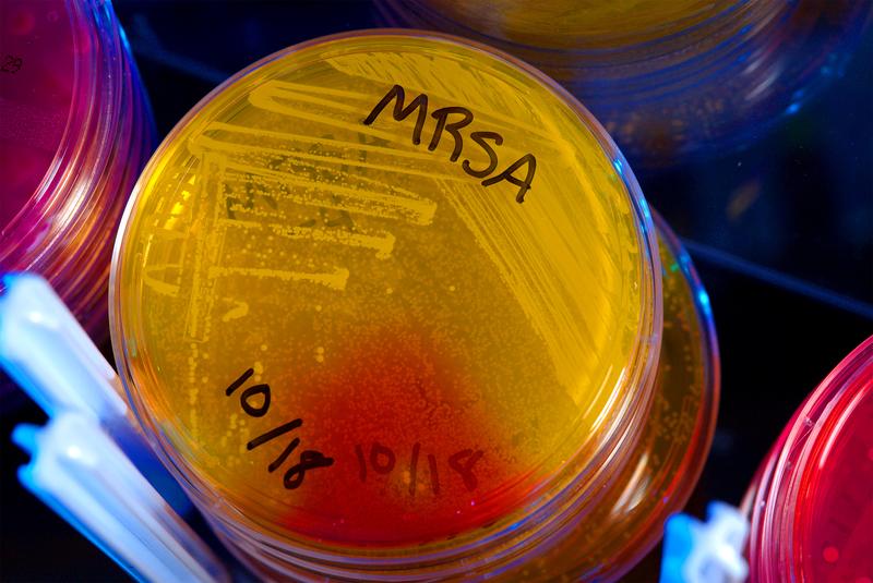 In dieser Petrischale wachsen MRSA-Keime.