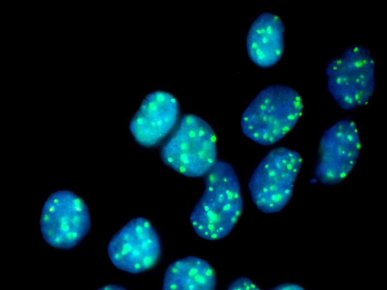 Immunofluoreszenzmikroskopie von HAP1 Zellen ohne FANCC-Gen, für 24 h mit MMC behandelt und gegen BRCA1, %§BP1 und DAPI gefärbt.