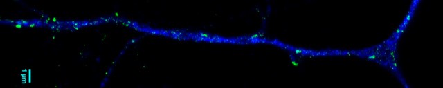 STED Bild eines Synapsenproteins (grün), das die Positionen der Synspsen auf einem Neuron (blue) anzeigt. 