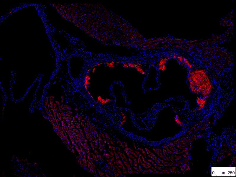 Immunofluoreszenzfärbung von atherosklerotischen Plaques (rot) in der Aorta einer Maus, der das Gen für TACI in myeloiden Zellen fehlt (adaptiert von Tsiantoulas et al., Circulation 2018)