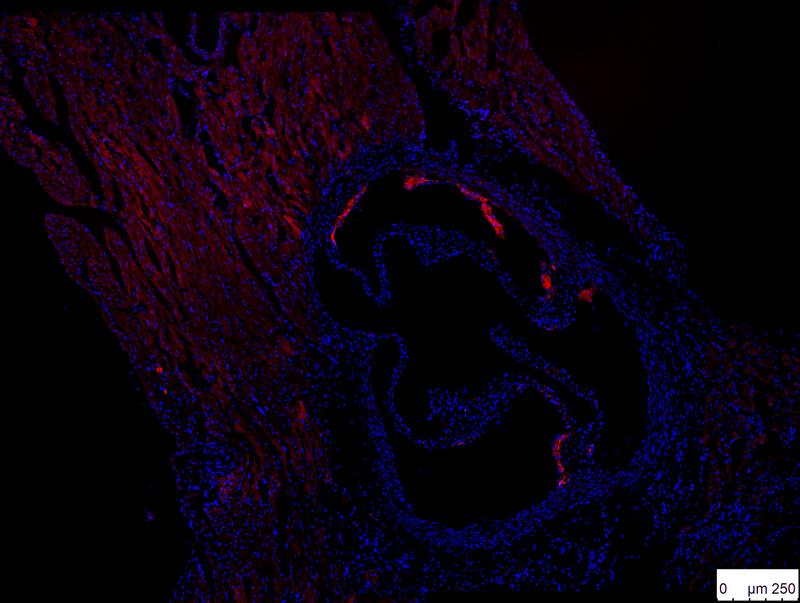 Immunofluoreszenzfärbung von atherosklerotischen Plaques (rot) in der Aorta einer Wildtyp-Maus (adaptiert von Tsiantoulas et al., Circulation 2018)
