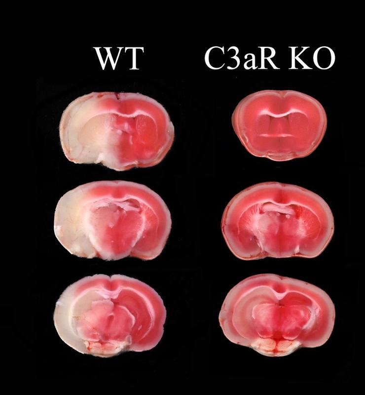 Links: nach einem Schlaganfall ist das geschädigte Hirnareal (weiß) relativ groß. Rechts: Wenn das Gen für C3aR fehlt, bleibt der Infarkt vergleichsweise klein.