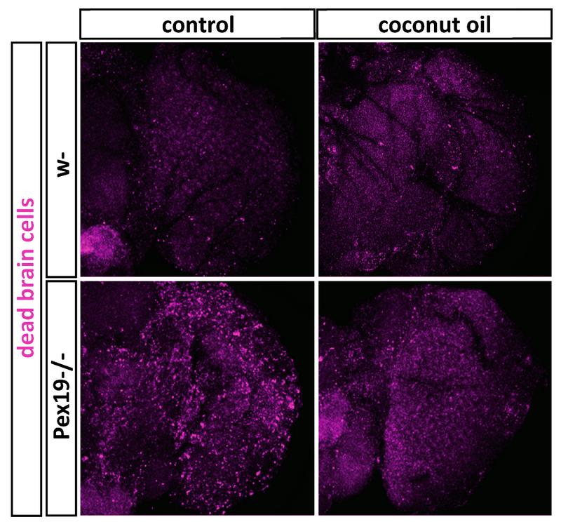 In Kontrollen (oben rechts und links) sind wenig abgestorbene Gehirnzellen (magenta). Fliegen ohne Peroxisomen haben dagegen viele (unten links), was sich durch Kokosöldiät verbessert (unten rechts).