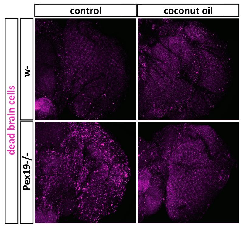 In controls (top right and left) are only few dead brain cells (magenta). Without peroxisomes (lower left) there are a lot. With coconut oil it improves (lower right). 